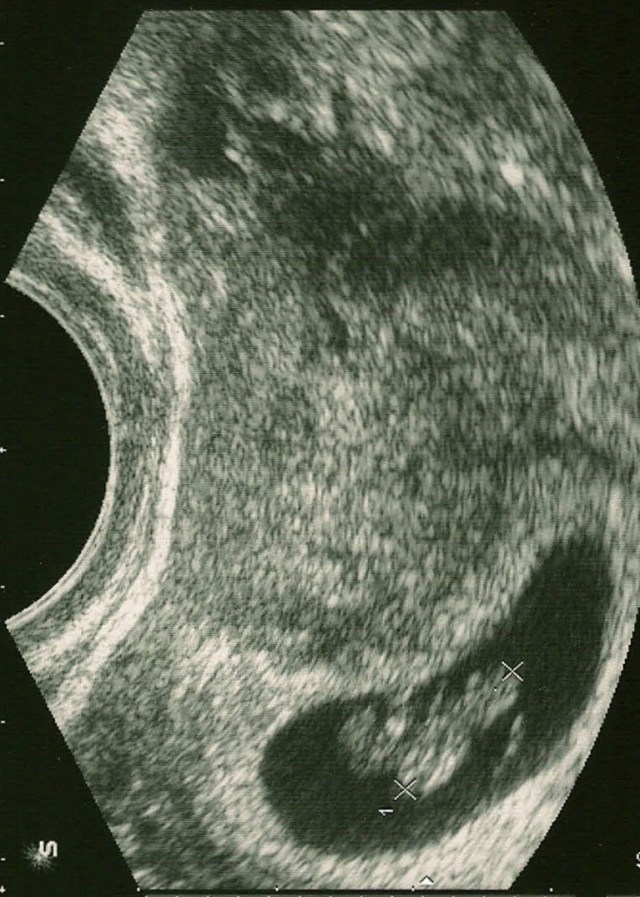 ultrasound -copyright 2009©passionsandsoapboxes